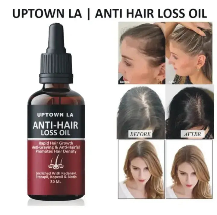 UP Town LA Anti Hair Loss Serum MZ2607200010SMTG