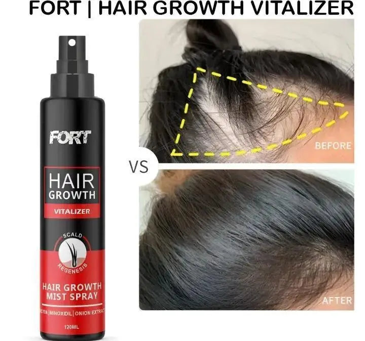 Fort Hair Growth Spray MZ2607200087SMTG