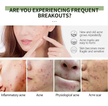 Anti-Aging Exfoliating Facial Gel MZ2607200049SMTG