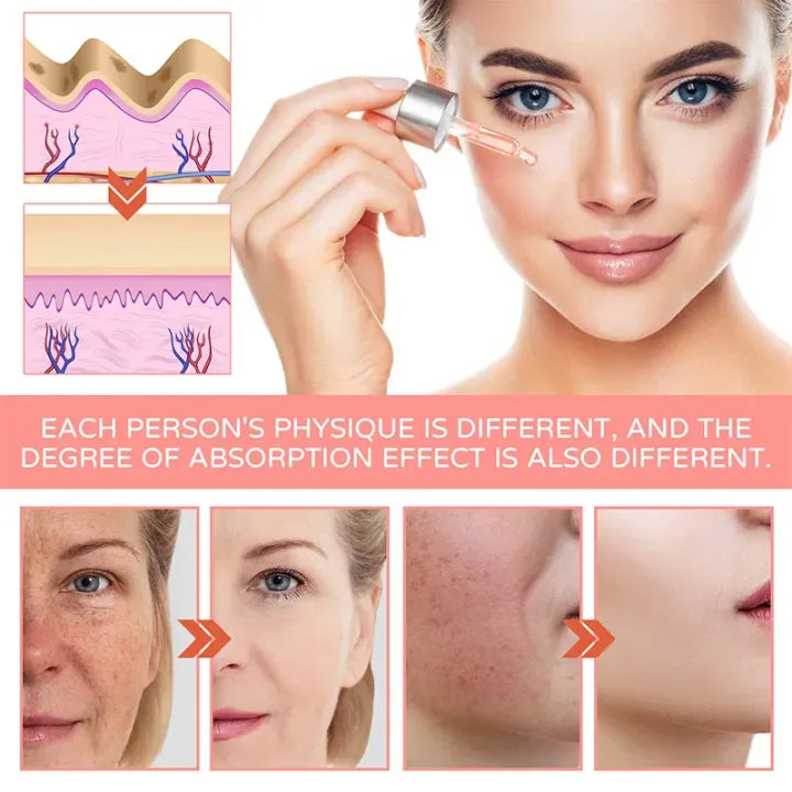 FORT 5IN1 Whitening Serum — Brightens Skin Tone, Removes Dead Skin